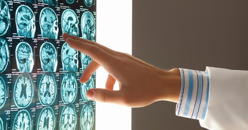 Close-up image of doctors hand pointing at x-ray results